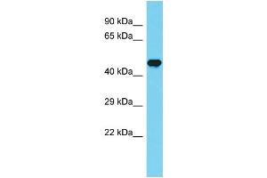 Host: Rabbit Target Name: CCDC121 Sample Type: Fetal Brain lysates Antibody Dilution: 1. (CCDC121 antibody  (Middle Region))