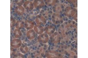 Used in DAB staining on fromalin fixed paraffin- embedded Kidney tissue (AASS antibody  (AA 477-926))