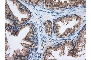 Immunohistochemical staining of paraffin-embedded Human liver tissue using anti-C17orf28 mouse monoclonal antibody. (HID1/DMC1 antibody)