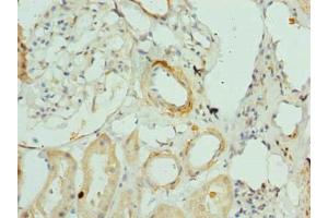 Immunohistochemistry of paraffin-embedded human kidney tissue using ABIN7144163 at dilution of 1:100 (ANKMY1 antibody  (AA 1-220))