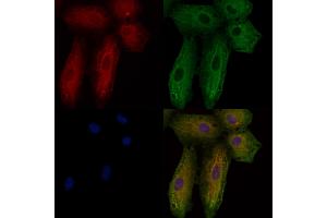 ABIN6257398 and ABIN6276108 staining  cells by IF/ICC. (Rho-related GTP-binding protein antibody  (C-Term))