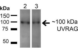 Western blot analysis of Human HeLa and 293T cell lysates showing detection of ~100kDa UVRAG protein using Rabbit Anti-UVRAG Polyclonal Antibody . (UVRAG antibody  (FITC))