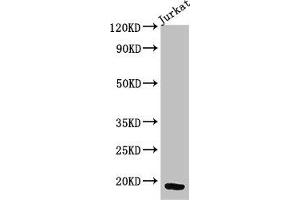 Western Blot Positive WB detected in: Jurkat whole cell lysate All lanes: CD247 antibody at 3 μg/mL Secondary Goat polyclonal to rabbit IgG at 1/50000 dilution Predicted band size: 19 kDa Observed band size: 19 kDa (CD247 antibody  (AA 88-153))
