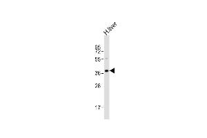 Anti-LMX1A Antibody (C-term)at 1:2000 dilution + human liver lysates Lysates/proteins at 20 μg per lane. (LMX1A antibody  (C-Term))