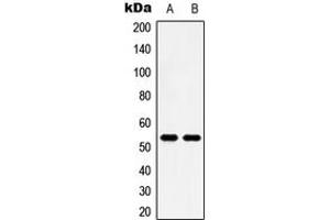 Western blot analysis of 5-HT2B expression in HeLa (A), HT29 (B) whole cell lysates.