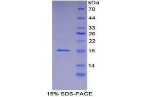 SDS-PAGE analysis of Human Laminin alpha 1 Protein.