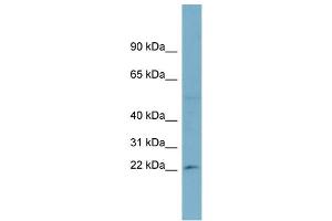 WB Suggested Anti-RPL13A  Antibody Titration: 0.