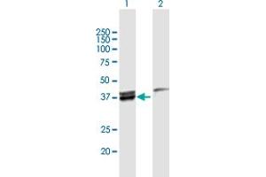 Western Blot analysis of MECR expression in transfected 293T cell line by MECR MaxPab polyclonal antibody. (MECR antibody  (AA 1-373))