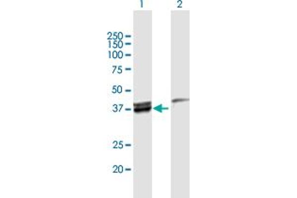 MECR Antikörper  (AA 1-373)