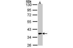 Image no. 1 for anti-Speckle-Type POZ Protein (SPOP-B) (AA 1-193) antibody (ABIN467492) (SPOP-B antibody  (AA 1-193))