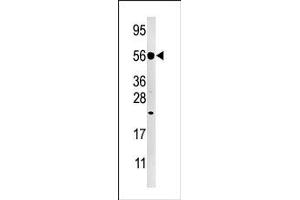 Image no. 1 for anti-Dual Specificity Phosphatase 8 (DUSP8) (C-Term) antibody (ABIN360785) (DUSP8 antibody  (C-Term))