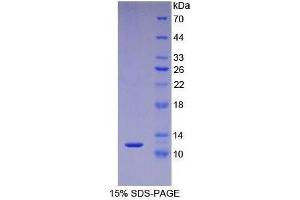 SDS-PAGE (SDS) image for S100 Calcium Binding Protein A5 (S100A5) (AA 1-92) protein (His tag) (ABIN1080729)
