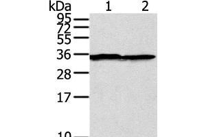 Western Blot analysis of A375 cell using STX3 Polyclonal Antibody at dilution of 1:400 (STX3 antibody)