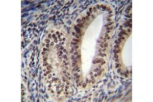 Progesterone Receptor antibody immunohistochemistry analysis in formalin fixed and paraffin embedded human uterus tissue. (Progesterone Receptor antibody  (AA 349-377))