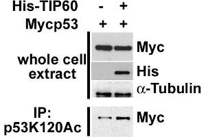 Western Blotting (WB) image for anti-Tumor Protein P53 (TP53) (acLys315) antibody (ABIN3201007) (p53 antibody  (acLys315))