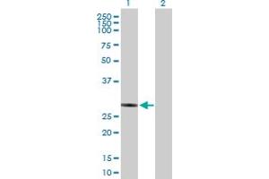 Western Blot analysis of NUBPL expression in transfected 293T cell line by NUBPL MaxPab polyclonal antibody. (NUBPL antibody  (AA 1-289))