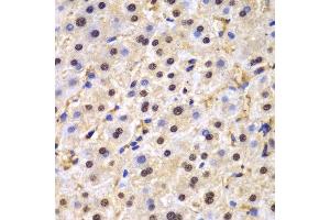 Immunohistochemistry (IHC) image for anti-TAR DNA Binding Protein (TARDBP) (AA 1-260) antibody (ABIN3021656) (TARDBP antibody  (AA 1-260))