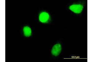 Immunofluorescence of monoclonal antibody to HOXC4 on HeLa cell. (HOXC4 antibody  (AA 160-264))