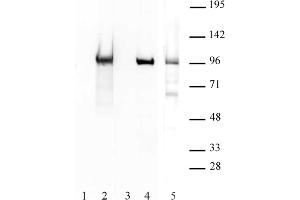 BORIS / CTCFL antibody (pAb) tested by Western blot. (CTCFL antibody  (N-Term))