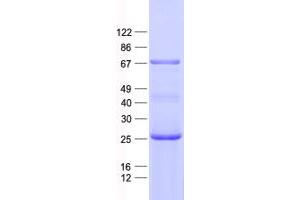 Western Blotting (WB) image for Centrosomal Protein 63kDa (CEP63) protein (His tag) (ABIN2713919)