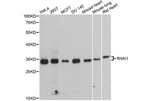 Western blot analysis of extracts of various cell lines, using SNAI1 antibody (ABIN4905248) at 1:1000 dilution. (SNAIL antibody)