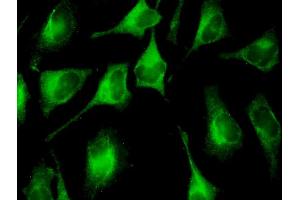 Immunofluorescence of monoclonal antibody to FAU on HeLa cell. (FAU antibody  (AA 1-133))
