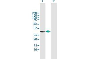 Western Blot analysis of THAP1 expression in transfected 293T cell line by THAP1 MaxPab polyclonal antibody. (THAP1 antibody  (AA 1-213))