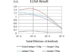 Black line: Control Antigen (100 ng),Purple line: Antigen (10 ng), Blue line: Antigen (50 ng), Red line:Antigen (100 ng) (SSTR2 antibody)