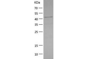 Western Blotting (WB) image for Inhibitor of kappa Light Polypeptide Gene Enhancer in B-Cells, Kinase gamma (IKBKG) (AA 1-419) protein (His tag) (ABIN7123433) (IKBKG Protein (AA 1-419) (His tag))
