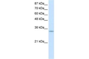 Western Blotting (WB) image for anti-Protein Kinase, Interferon-Inducible Double Stranded RNA Dependent Activator (PRKRA) antibody (ABIN2462150)