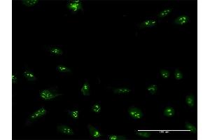 Immunofluorescence of purified MaxPab antibody to NIP7 on HeLa cell. (NIP7 antibody  (AA 1-180))