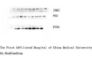 Western Blot (WB) analysis: Please contact us for more details. (NF-kB p65 antibody)