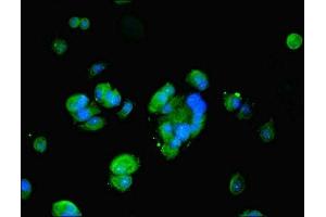 Immunofluorescent analysis of MCF-7 cells using ABIN7162823 at dilution of 1:100 and Alexa Fluor 488-congugated AffiniPure Goat Anti-Rabbit IgG(H+L) (FKBP1A antibody  (AA 2-103))