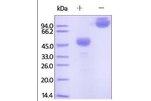 Cynomolgus CTLA-4, Fc Tag on SDS-PAGE under reducing (R) and no-reducing (NR) conditions. (CTLA4 Protein (AA 37-160) (Fc Tag))