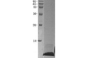 Validation with Western Blot (beta Defensin 1 Protein)