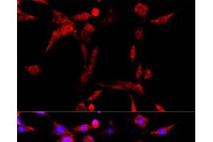 Immunofluorescence analysis of PC-12 cells using CYP1B1 Polyclonal Antibody at dilution of 1:100 (40x lens).