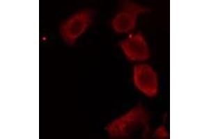 ABIN6276233 staining RAW264. (AVPR2 antibody  (Internal Region))