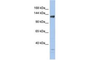Image no. 1 for anti-Lysine (K)-Specific Demethylase 4B (KDM4B) (AA 359-408) antibody (ABIN6744254) (KDM4B antibody  (AA 359-408))