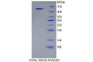 SDS-PAGE (SDS) image for Cathepsin A (CTSA) (AA 151-394) protein (His tag,GST tag) (ABIN2122575)