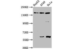 Western Blot Positive WB detected in: HepG2 whole cell lysate, A549 whole cell lysate, Hela whole cell lysate All lanes: NAIP antibody at 3. (NAIP antibody  (AA 147-242))
