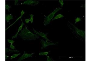 Immunofluorescence of monoclonal antibody to IRAK4 on HeLa cell. (IRAK4 antibody  (AA 255-351))