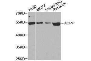 Western blot analysis of extracts of various cell lines, using ACPP antibody. (ACPP antibody  (AA 40-300))