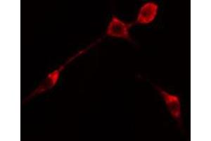 ABIN6274697 staining RAW264. (PHLDA1 antibody  (N-Term))