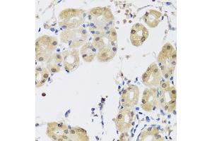 Immunohistochemistry of paraffin-embedded human stomach using YAP1 antibody. (YAP1 antibody)