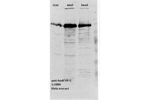 Western blot of anti-hnRNP-U on HeLa cell extract (HNRNPU antibody)