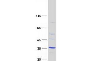 Validation with Western Blot (ATPBD4 Protein (Transcript Variant 1) (Myc-DYKDDDDK Tag))