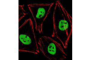 Immunofluorescent analysis of 4 % paraformaldehyde-fixed, 0. (PDX1 antibody  (AA 136-169))