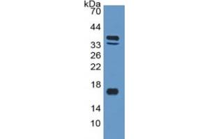 Mouse Capture antibody from the kit in WB with Positive Control: Sample Human Skeletal muscle lysate.