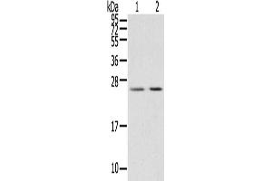 Gel: 12 % SDS-PAGE, Lysate: 40 μg, Lane 1-2: Human breast infiltrative duct tissue, Human placenta tissue, Primary antibody: ABIN7191460(MIG7 Antibody) at dilution 1/200, Secondary antibody: Goat anti rabbit IgG at 1/8000 dilution, Exposure time: 15 seconds (TOX4 antibody)