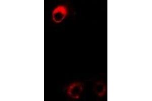 Immunofluorescent analysis of DDAH2 staining in Hela cells. (DDAH2 antibody)